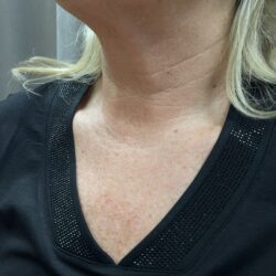 Svart topp med stenar - Bild 2