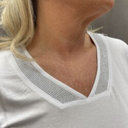Vit topp med stenar - Bild 2